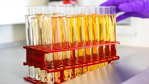 Rack full of test tubes filled with liquid